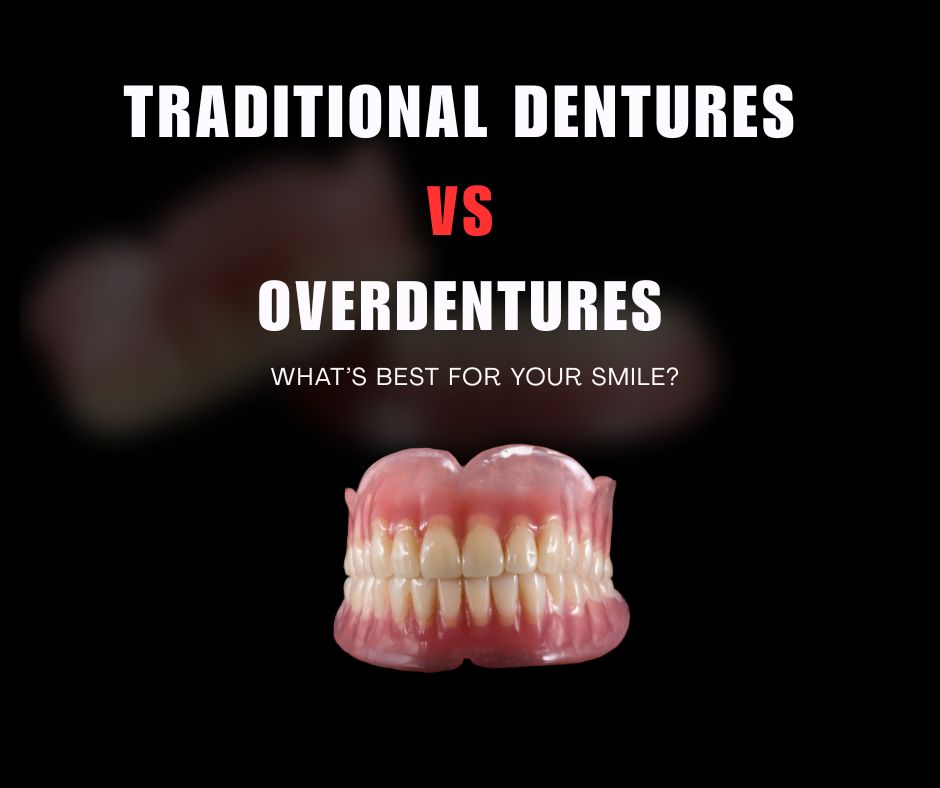 Traditional Dentures vs. Overdentures: A Comprehensive Guide
